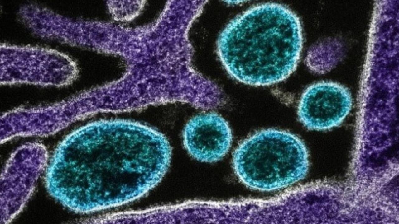 8 yaşındaki kız çocuğu nadir görülen beyin yiyen amip nedeniyle hayatını kaybetti
